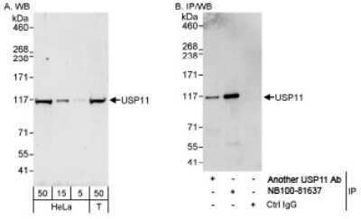 Western Blot: USP11 Antibody [NB100-81637]