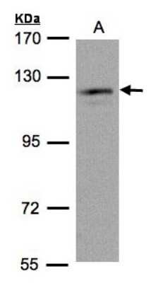 Western Blot: USP11 Antibody [NBP1-32810]