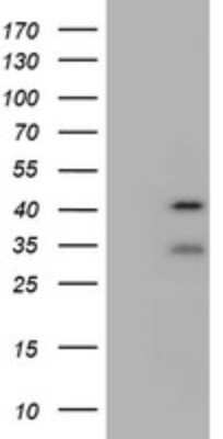 Western Blot: USP12 Antibody (OTI1E3) [NBP2-46298]