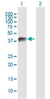 Western Blot: USP12 Antibody [H00219333-B01P]