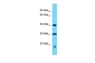 Western Blot: USP12 Antibody [NBP2-82372]