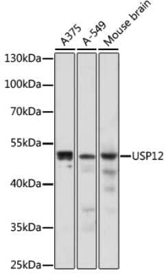 Western Blot: USP12 AntibodyAzide and BSA Free [NBP2-94449]