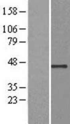 Western Blot: USP12 Overexpression Lysate [NBL1-17644]