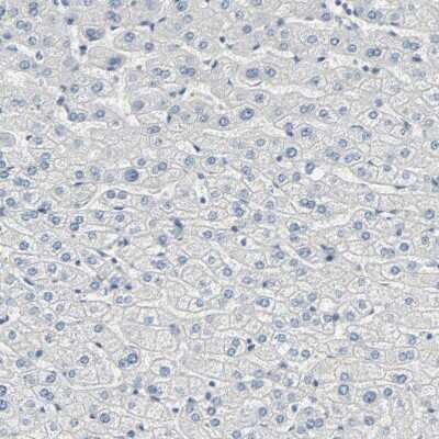 Immunohistochemistry: USP13 Antibody [NBP1-83088]