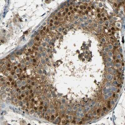 Immunohistochemistry-Paraffin: USP13 Antibody [NBP1-83088]
