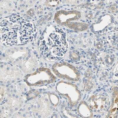 Immunohistochemistry-Paraffin: USP13 Antibody [NBP1-83088]