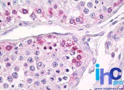 Immunohistochemistry-Paraffin: USP13 Antibody [NBP2-24575]