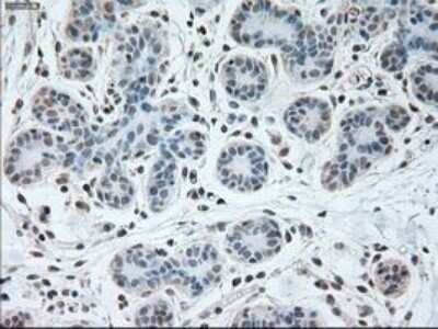 Immunohistochemistry: USP13 Antibody (OTI4G11) - Azide and BSA Free [NBP2-74802]