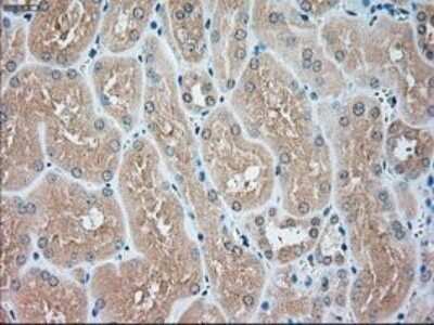 Immunohistochemistry: USP13 Antibody (OTI4G11) - Azide and BSA Free [NBP2-74802]