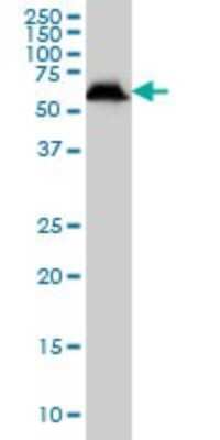 Western Blot: USP14 Antibody (6D6) [H00009097-M04]