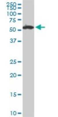 Western Blot: USP14 Antibody (6D6) [H00009097-M04]