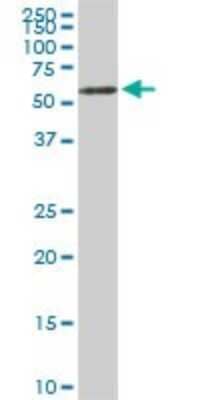 Western Blot: USP14 Antibody (6D6) [H00009097-M04]