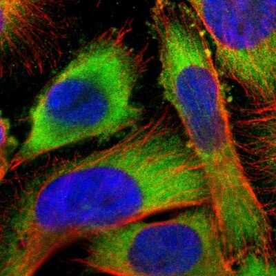 Immunocytochemistry/ Immunofluorescence: USP14 Antibody [NBP1-86946]