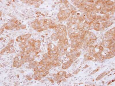 Immunohistochemistry-Paraffin: USP14 Antibody [NBP2-20825]