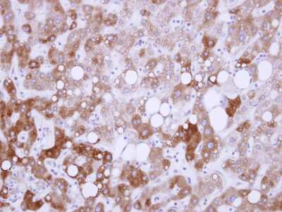 Immunohistochemistry-Paraffin: USP14 Antibody [NBP2-20826]