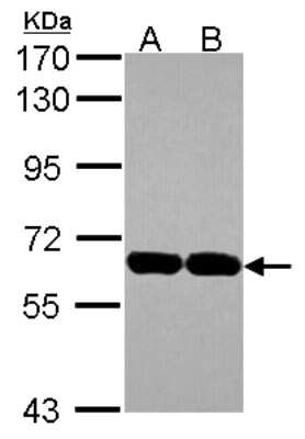 Western Blot: USP14 Antibody [NBP2-20825]
