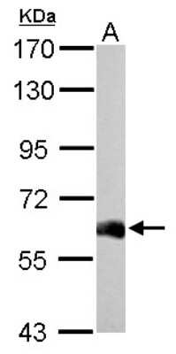 Western Blot: USP14 Antibody [NBP2-20825]