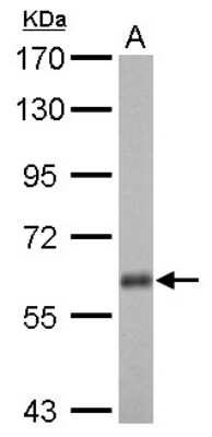 Western Blot: USP14 Antibody [NBP2-20825]