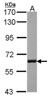 Western Blot: USP14 Antibody [NBP2-20826]