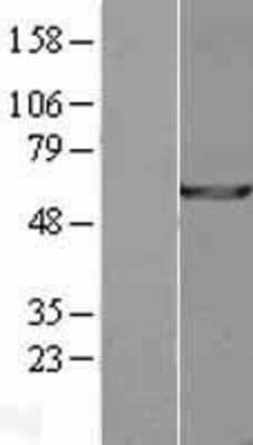 Western Blot: USP14 Overexpression Lysate [NBL1-17646]