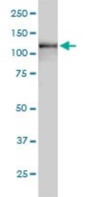 Western Blot: USP15 Antibody (1C10) [H00009958-M01]