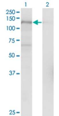 Western Blot: USP15 Antibody (1C10) [H00009958-M01]