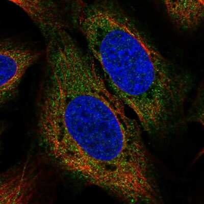 Immunocytochemistry/ Immunofluorescence: USP15 Antibody [NBP2-58023]