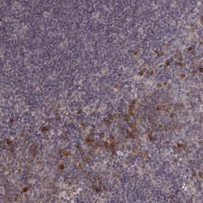 Immunohistochemistry-Paraffin: USP15 Antibody [NBP2-58886]