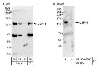 Western Blot: USP15 Antibody [NB110-40690]
