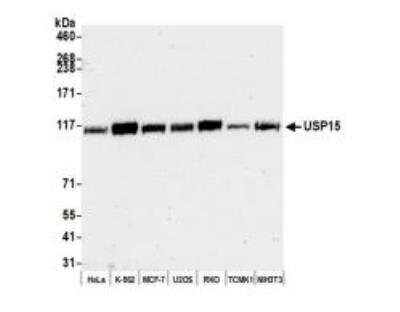 Western Blot: USP15 Antibody [NB110-40690]