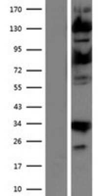 Western Blot: USP15 Overexpression Lysate [NBP2-07641]