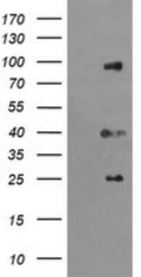 Western Blot: USP16 Antibody (OTI1B4) [NBP2-46305]