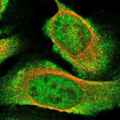 Immunocytochemistry/ Immunofluorescence: USP16 Antibody [NBP1-86881]