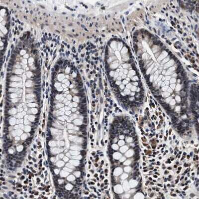 Immunohistochemistry-Paraffin: USP16 Antibody [NBP1-86881]