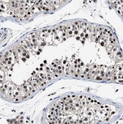 Immunohistochemistry-Paraffin: USP16 Antibody [NBP1-86881]