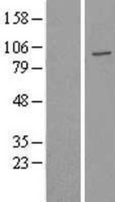 Western Blot: USP16 Overexpression Lysate [NBL1-17647]