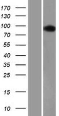 Western Blot: USP16 Overexpression Lysate [NBP2-09188]