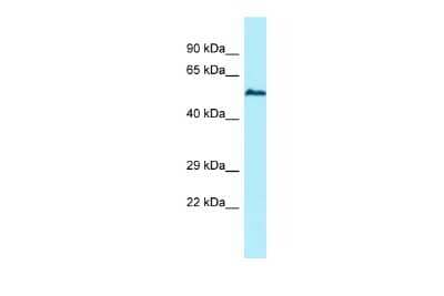 Western Blot: USP17L5 Antibody [NBP3-09464]