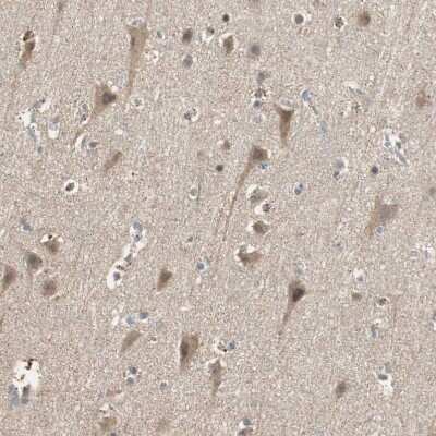 Immunohistochemistry-Paraffin: USP2 Antibody [NBP1-86882]