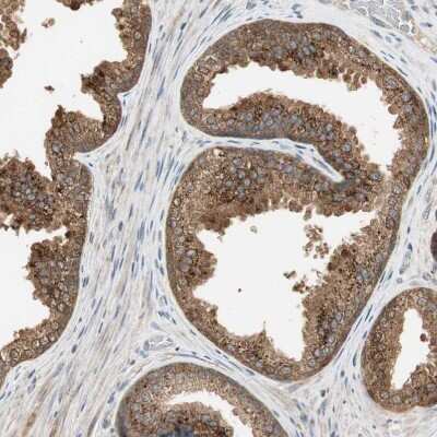 Immunohistochemistry-Paraffin: USP2 Antibody [NBP1-86882]
