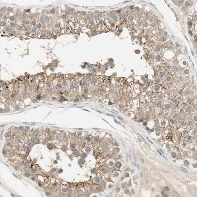 Immunohistochemistry-Paraffin: USP2 Antibody [NBP1-86882]