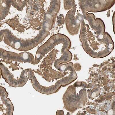 Immunohistochemistry-Paraffin: USP2 Antibody [NBP1-86883]