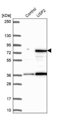 Western Blot: USP2 Antibody [NBP1-86882]