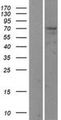 Western Blot: USP2 Overexpression Lysate [NBP2-04268]