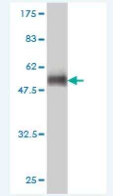 Western Blot: USP20 Antibody (1A6) [H00010868-M01]