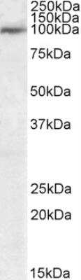 Western Blot: USP20 Antibody [NB100-1260]