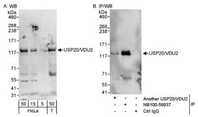 Western Blot: USP20 Antibody [NB100-59837]