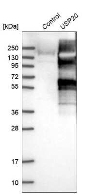 Western Blot: USP20 Antibody [NBP1-82946]