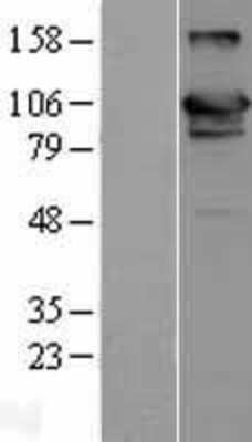 Western Blot: USP20 Overexpression Lysate [NBL1-17651]