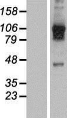 Western Blot: USP20 Overexpression Lysate [NBL1-17652]